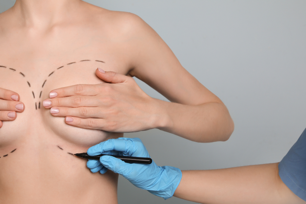 How to Know If You Need Breast Revision Surgery